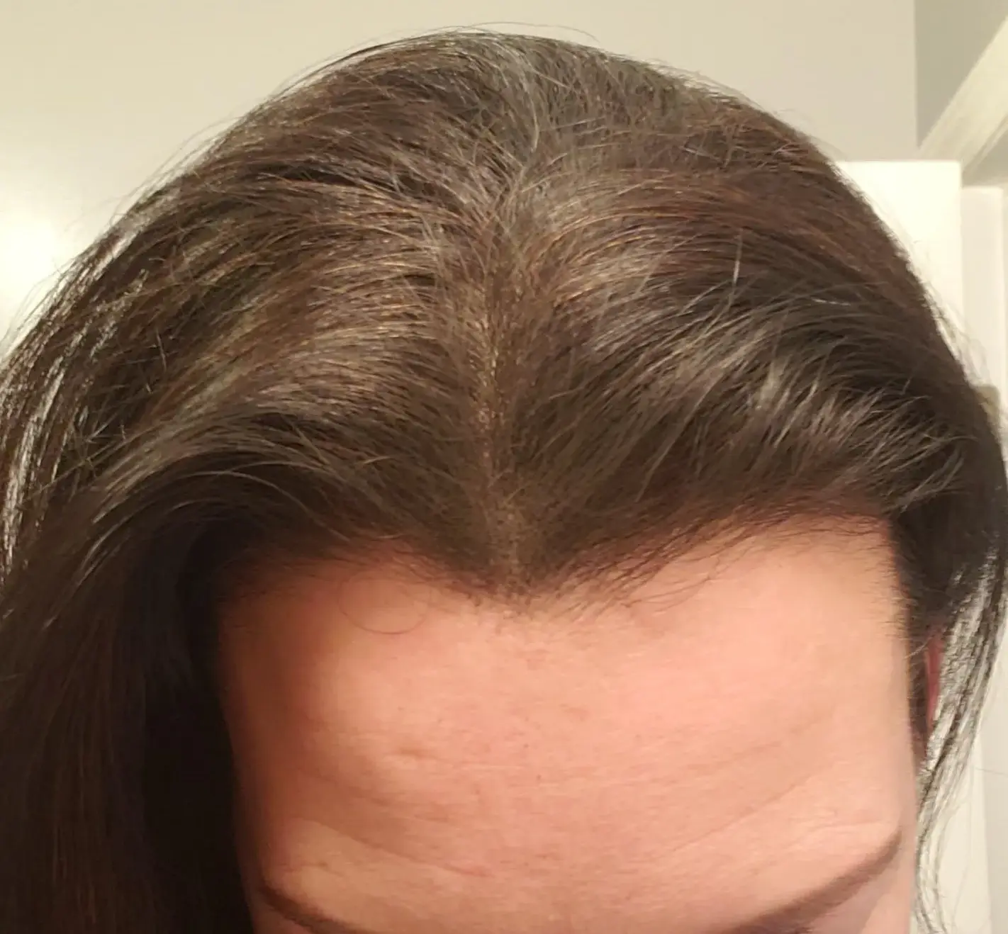 Resultado con BUNEE Hair Retouch aplicado