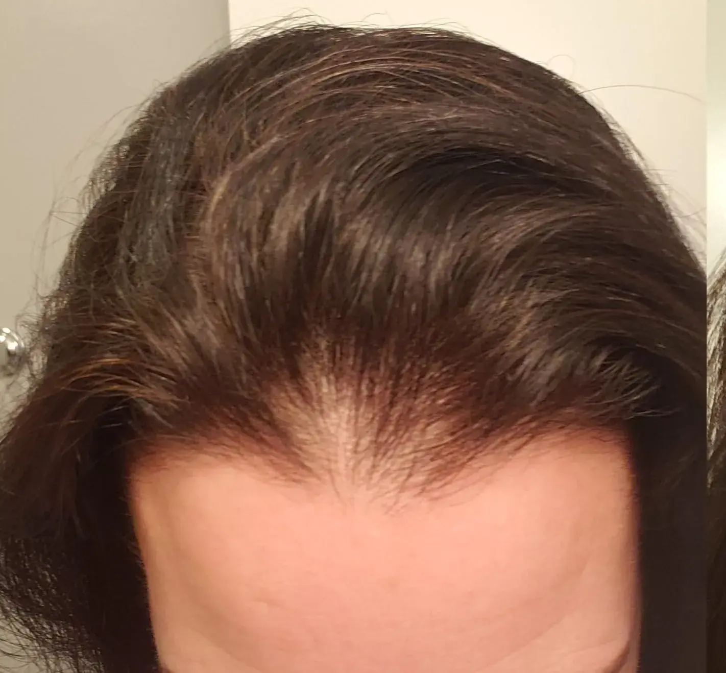 Antes de aplicar BUNEE Hair Retouch